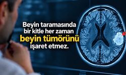 Beyin MR’ında beyaz lekeler ne anlama gelir? Nedenleri ve önemli işaretler