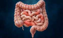 Şikâyet azalınca hastalık bitti sanılabilir: Crohn’da sessiz iltihap neden önemli?