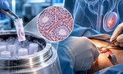 Üç Yıl Dondurulan Testis Dokusu Yeniden Nakledildi