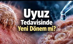 Uyuz paraziti ve yumurtaları deneysel tedaviyle ortadan kaldırıldı