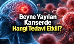 Beyin Metastazında Tedavi Değişiyor: Ameliyat ve Işın Tedavisine Yeni Seçenekler