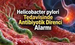 Helicobacter pylori Neden Tedaviye Direnç Gösteriyor? BMJ’den Önemli Değerlendirme