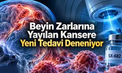 Beyin Zarlarına Yayılan Kansere Karşı Yeni Tedavi İnsanlarda Deneniyor