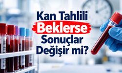Kan Tahlili Sonuçları Bekleme Süresinden Etkilenebilir: Yeni Araştırmanın Bulguları