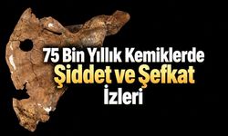 75 Bin Yıllık İskelette İki İz: Ölümcül Darbe ve Bakımın İşaretleri