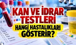 Hangi Tahlil Neyi Gösterir? Kan, İdrar ve Hormon Testleri Tablosu