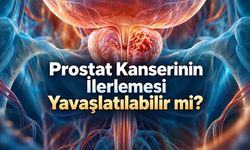 Prostat kanserinin ilerlemesi yavaşlatılabilir mi? Beslenme ve egzersizin rolü