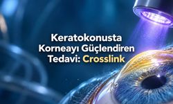 Keratokonus crosslink ameliyatı nedir, kimlere yapılır?