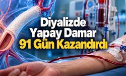 Yapay İnsan Damarı Diyaliz Hastalarında 91 Günlük Avantaj Sağladı