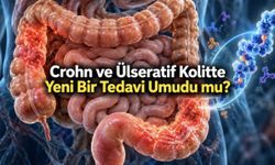 Zayıflama İlaçları Crohn ve Ülseratif Kolitte Ameliyat Riskini Azaltabilir mi?