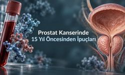 Prostat kanseri riskine ilişkin ipuçları, tanıdan 15 yılı aşkın süre önce alınan kanda bulundu