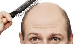 Saç Dökülmesi Neden Artıyor? Şampuanlar ve Bitkisel Yöntemler Ne Kadar Etkili?