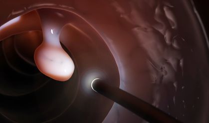 Kolonoskopi Öncesi Hazırlık Neden Önemli?