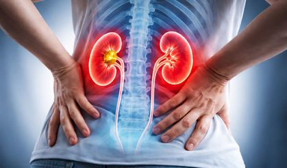 Böbrek Taşı Neden Olur? En Sık 7 Sebep