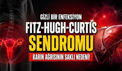 Fitz-Hugh-Curtis sendromu nasıl anlaşılır? Karın ağrısında gizli risk