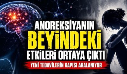 Anoreksiyanın Beyindeki Etkisi Yeni Tedavilerin Kapısını Aralayabilir