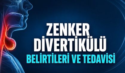 Zenker Divertikülü (Yemek Borusunda Keseleşme) Belirtileri ve Tedavisi