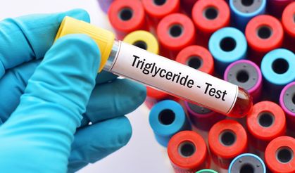 Trigliserit Nasıl Düşürülür? Bilimsel Veriler Etkili Yöntemleri Ortaya Koydu
