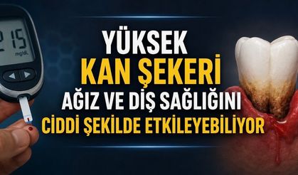 Kontrolsüz Diyabet Ağız Kuruluğu, Diş Eti Hastalığı ve Diş Kaybına Yol Açabiliyor