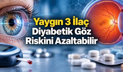 İbuprofen, Setirizin ve Prednizon Diyabetik Göz Hastalığı Riskini Azaltabilir mi?