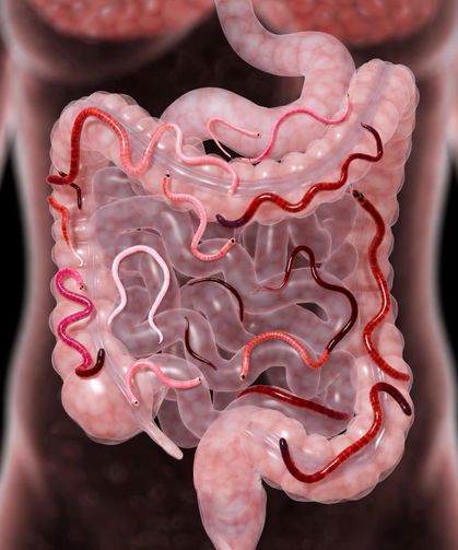 Belirti Vermeden Organlara Zarar Veren Parazit Solucanlar