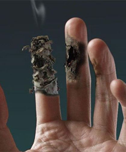 Buerger Hastalığı Belirtileri, Teşhisi ve Güncel Tedavileri