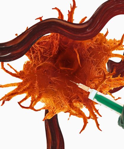 Kanser tedavisinde umut veren yeni yöntem: Tümöre enjekte edilen antikorlar bazı hastalarda tamamen yok etti