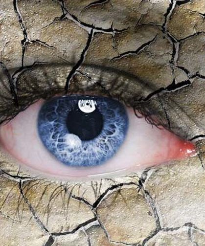 Göz kuruluğu neden olur, nasıl anlaşılır, kendiliğinden geçer mi?