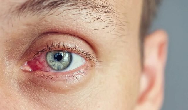 Prof. Dr. Banu Açıkalın: “Göz Kuruluğu Yaygın Bir Sorun, Önlenebilir ve Tedavi Edilebilir”