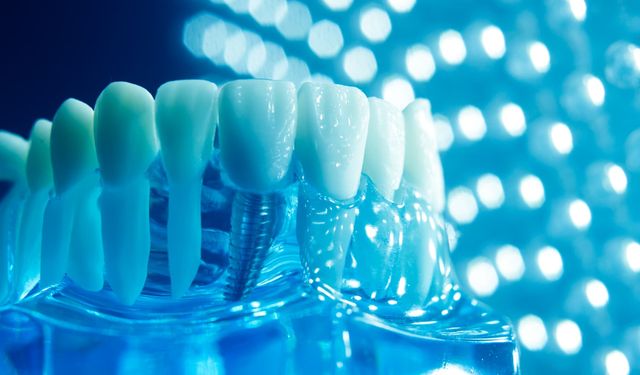 Bruksizm Nedir? Diş Sıkma Nasıl Teşhis Edilir, Güncel Tedavisi Nedir?