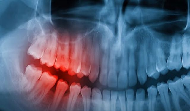 İmplant yerine doğal diş mümkün mü? İnsan deneyleri başladı