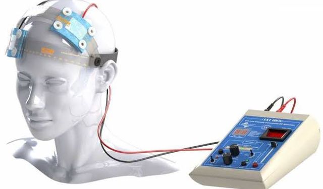 FDA depresyonda tDCS beyin uyarım cihazına onay verdi