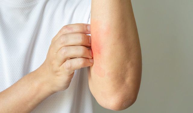 Nedensiz kaşıntı, vücudun sessiz ama ciddi bir uyarısı olabilir.