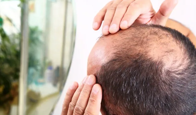 Saç Dökülmesi Neden Artıyor? Şampuanlar ve Bitkisel Yöntemler Ne Kadar Etkili?