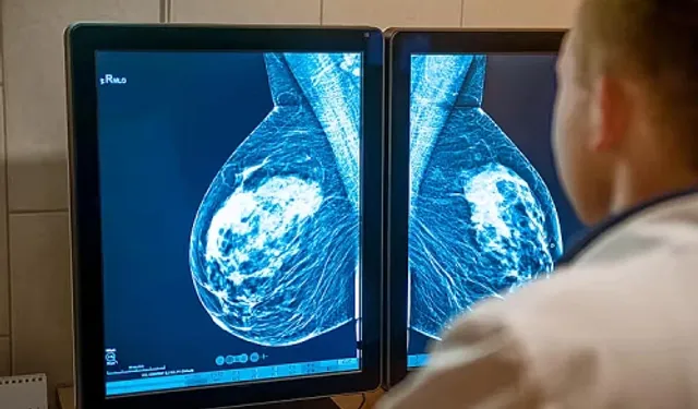 Sıkı Sütyen Giymek Meme Kanseri Riskini Artırır mı?