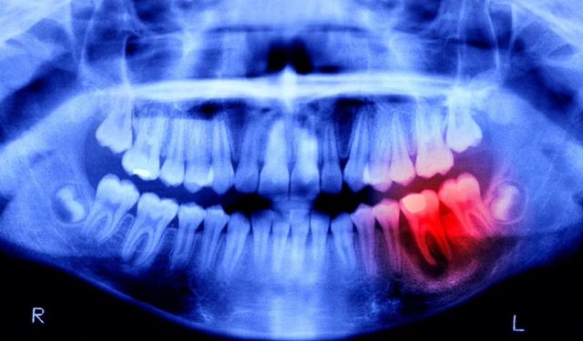 Japonya’dan devrim niteliğinde adım: İnsanlarda dişlerin yeniden çıkmasını sağlayan ilaç denemeleri başladı