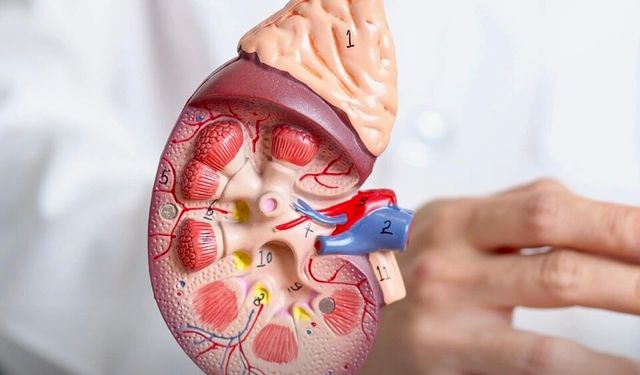 Böbrek Taşı Geçirenlerde Kanser Riski Daha mı Yüksek?