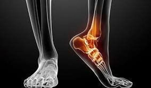 Ayak Bileği Kırığında Alçı mı Ameliyat mı? Yeni Çalışma Dikkat Çekti