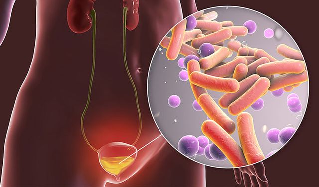 İdrar Yolu Enfeksiyonlarında Gizli Risk: Kalıcı Bakteriler