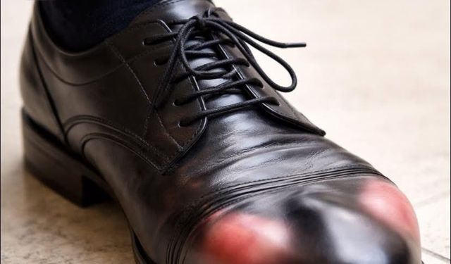 Dar Ayakkabı Sessiz Tehlike: Ayak Sağlığını Bozuyor, Yürümeyi Kâbusa Çeviriyor