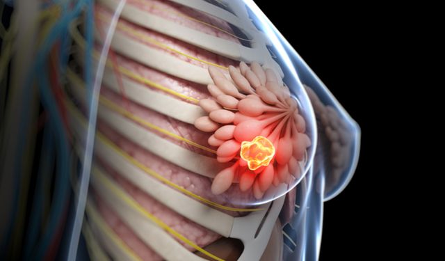 Yeni Bulgular, Genç Kadınlarda Meme Kanserinin Daha Agresif Seyredebileceğine İşaret Ediyor