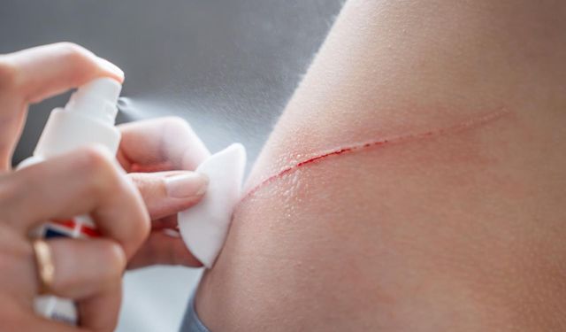 Kanamaya Saniyeler İçinde Set Çeken Toz Geliştirildi