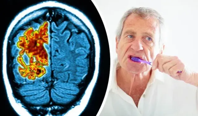 Alzheimer Araştırmalarında Yeni Cephe: Ağız Sağlığı