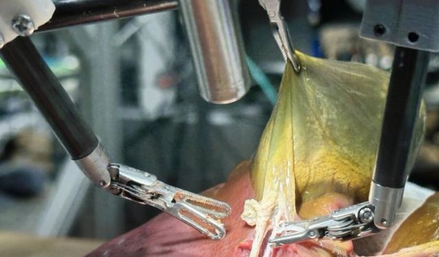 Yapay Zekâlı Cerrah Robot Deneysel Modelde Operasyon Yaptı