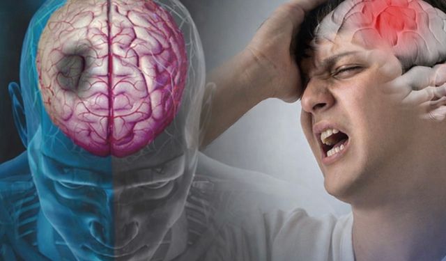 İnme Belirtileri Nelerdir? Hayat Kurtaran 7 Kritik Uyarı