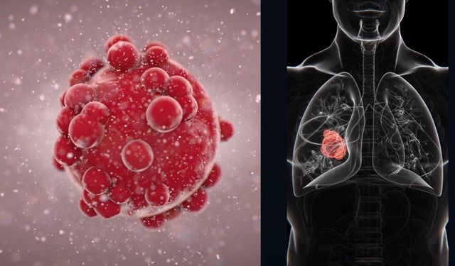 Akciğer Kanserinde Yeni Umut: Sevabertinib Yüzde 59 Yanıt Sağladı