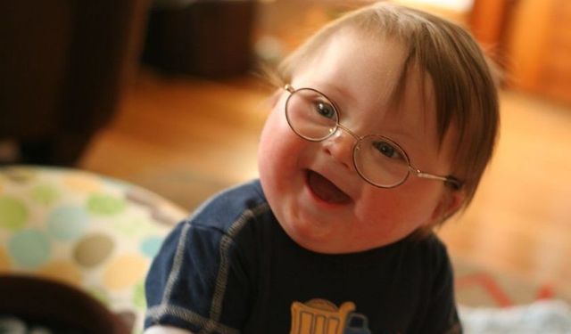 Down Sendromu: Bir Fazlalık Değil, Farklı Bir Ritmin Hikâyesi