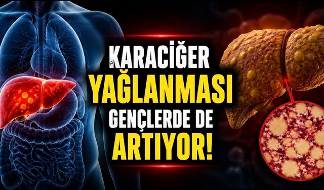Sessiz Tehlike: Karaciğer Yağlanması Gençlerde de Artıyor