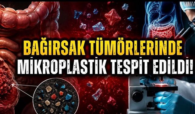 Bağırsak Tümörlerinde Mikroplastik İzleri: Nature Health’ten Dikkat Çeken Çalışma