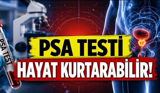 PSA Testi Tartışmasında Yeni Dönem: Prostat Kanseri Ölümlerini Azaltabilir